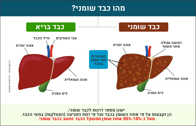 מה זה כבד שומני - תרשים המציג הבדלים בין כבד בריא לכבד שומני