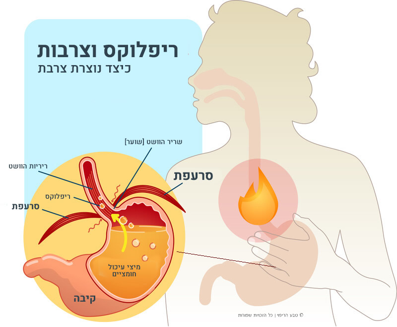 דיספגיה – קושי בבליעה – סיבות, אבחון וטיפול נטורופתי